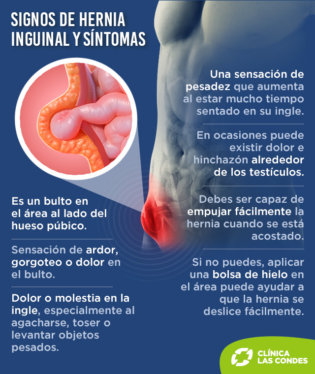 Hernia Inguinal: Causas, Síntomas y Tratamiento - Camde