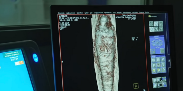 CLÍNICA LAS CONDES ESTUDIA MOMIA EGIPCIA CON TOMOGRAFÍA AVANZADA