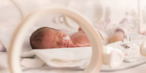 NIÑO PREMATURO
